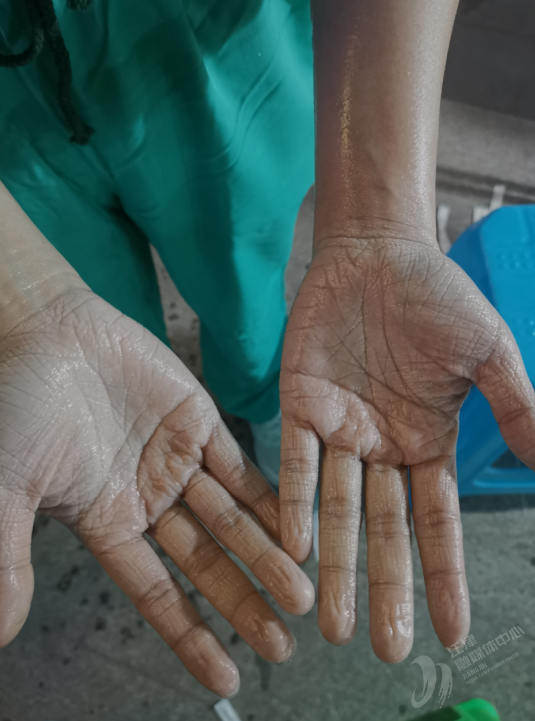 这双一线护士的手让人瞬间破防